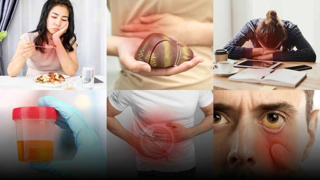 เผยสัญญาณเตือน ‘โรคไขมันพอกตับ’ ภัยเงียบที่ไม่รู้ตัว รู้เร็ว รักษาทัน